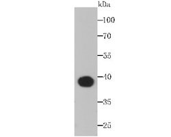 Aldolase A Rabbit anti-Human, Mouse, Rat, Zebrafish, Clone: JM54-19, Novus